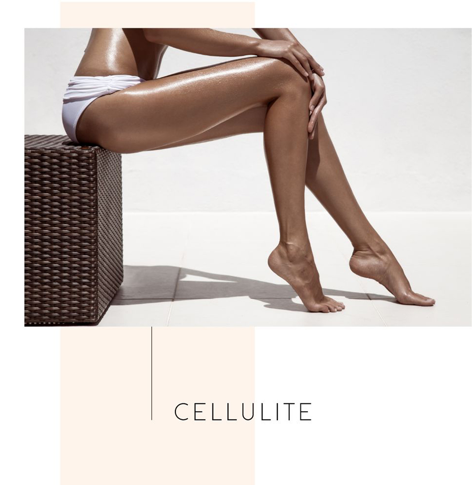 cellulite - illustration